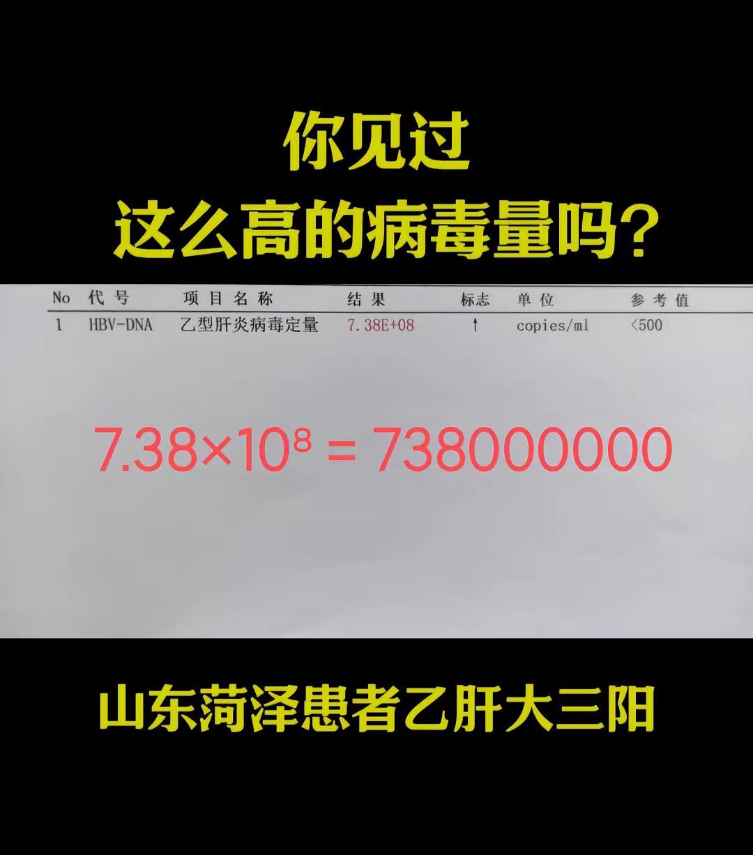 乙肝病毒量从“上亿”到0！3个方案坚持3个月，很多人也在做！  1、规...