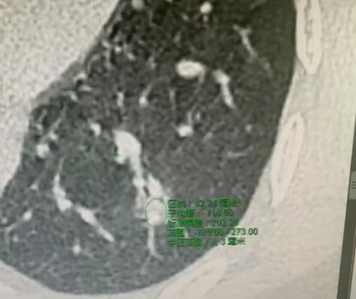 门诊碰到个有意思又让人心疼的患者，43岁，一进门就风风火火的，嗓门都带着急，上来