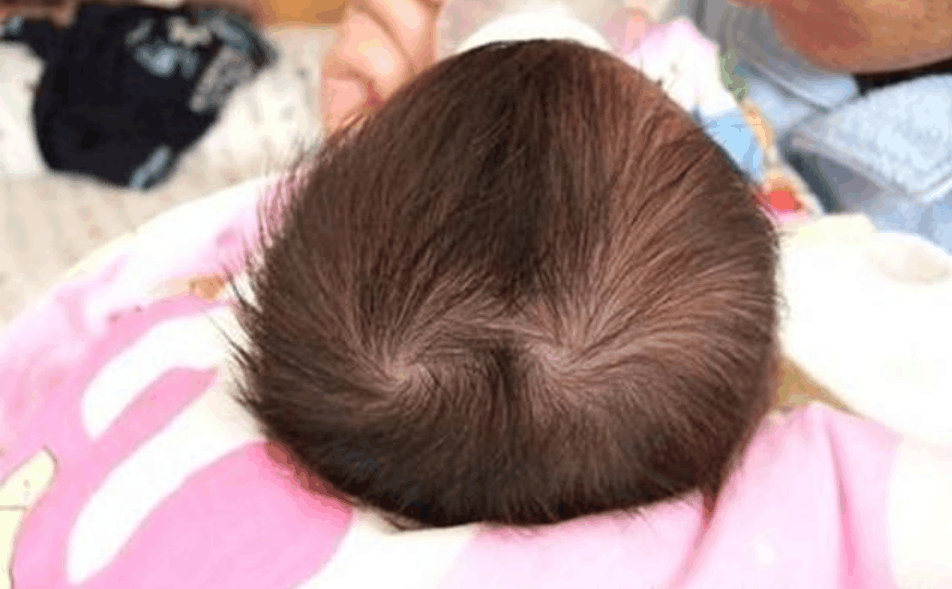 从孩子头上的旋可以知道孩子性格? 你家孩子有几个