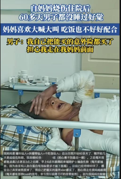 是妈妈自私，还是儿子不孝顺？一妈妈大面积烧伤住院后，60多天儿子都没睡过好觉