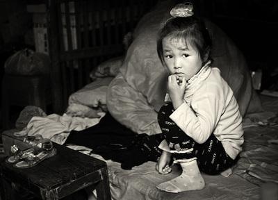 3岁孩子头上长满虱子, 奶奶的做法, 医生叹其愚昧