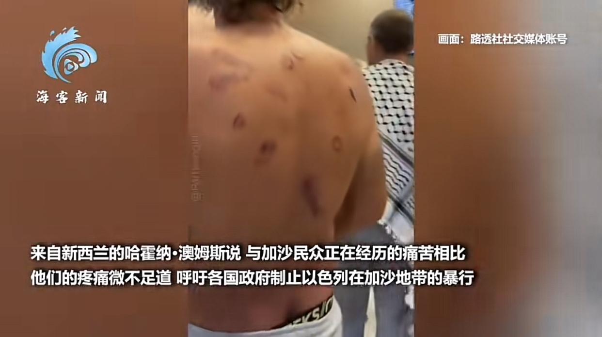 40多国遭以色列迫害的援助加沙国际活动人士抵达土耳其，以军暴行遭披露！5月21日