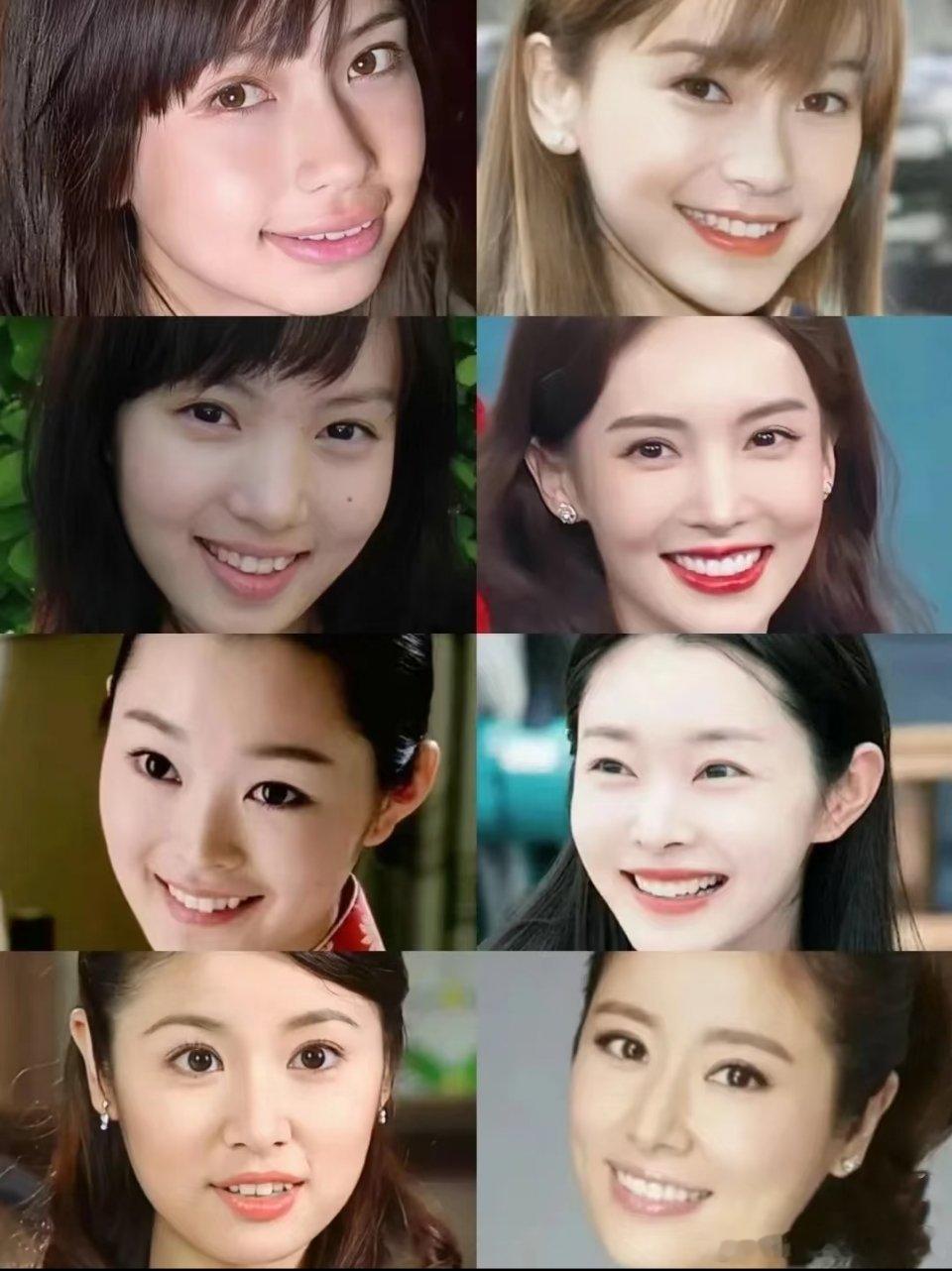 有网友说:整牙可以改变面相大家怎么看啊？