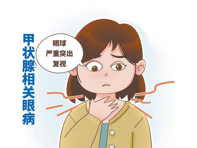 当心甲状腺疾病连累眼睛