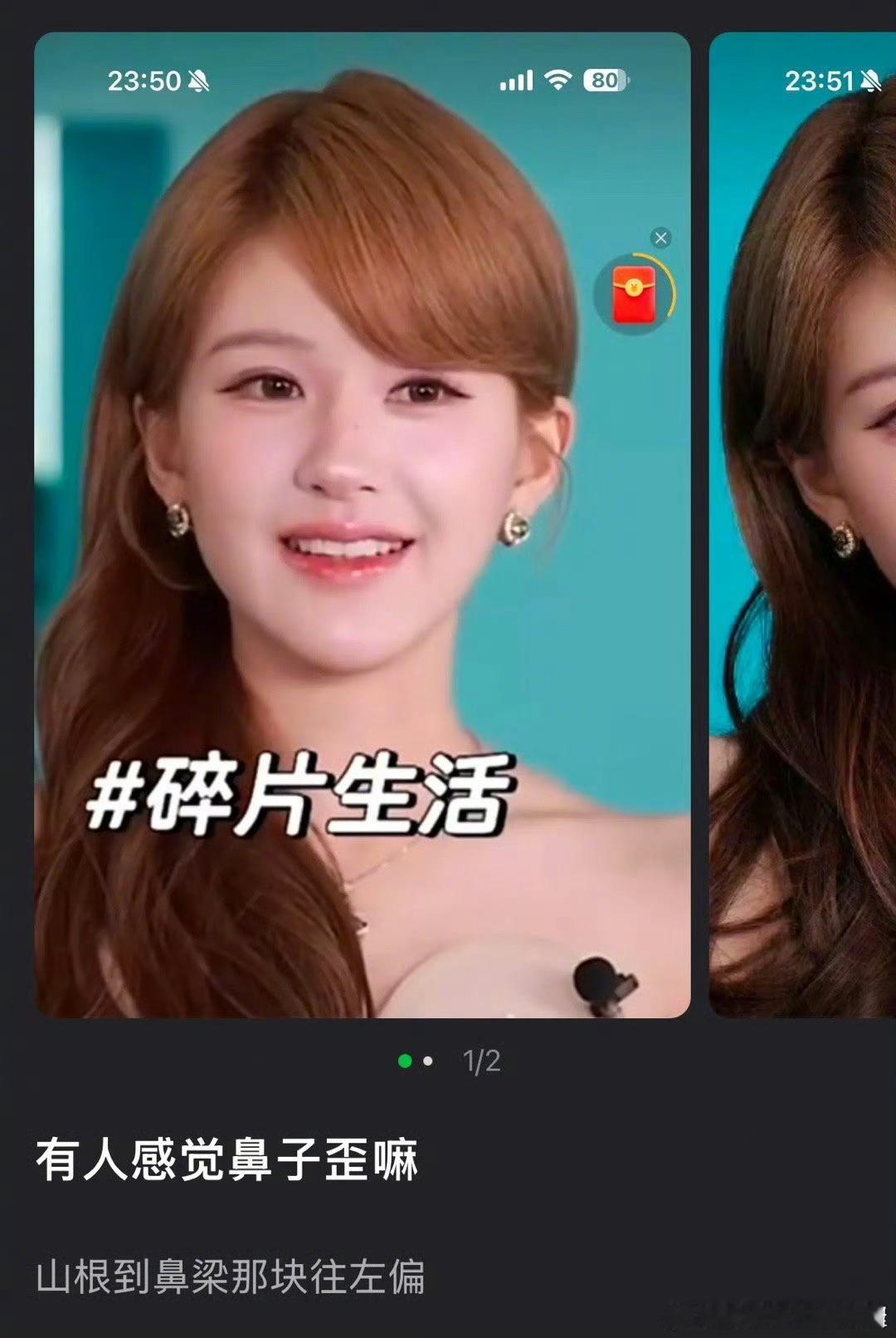赵露思鼻子怎么歪了​​​