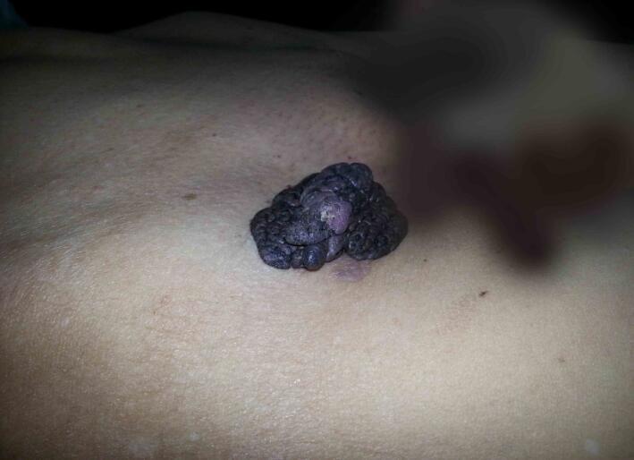 身体上有这些小的变化一定要注意, 可能你的身体里已经长了东西!