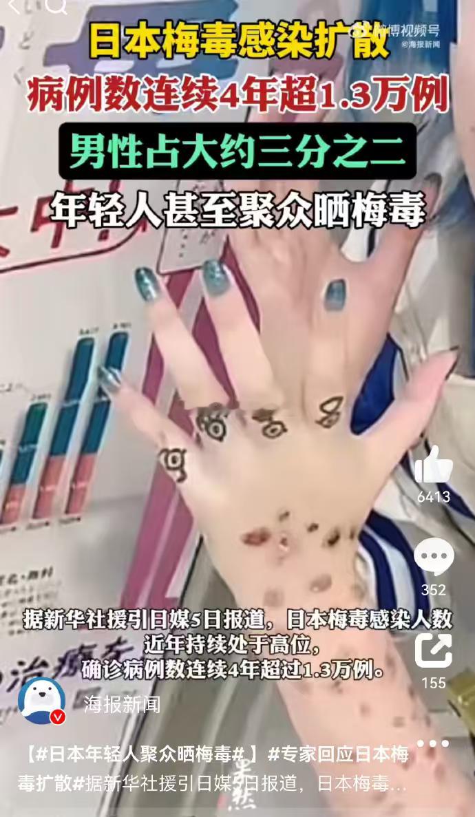 日本年轻人聚众晒梅毒各位晚安哦绝对不能我一个人眼瞎