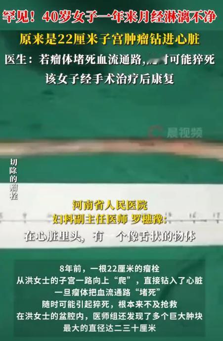 太震惊了！河南的一位40岁的女子，因月经异常多次就医，然而一直未能查出病因。最终