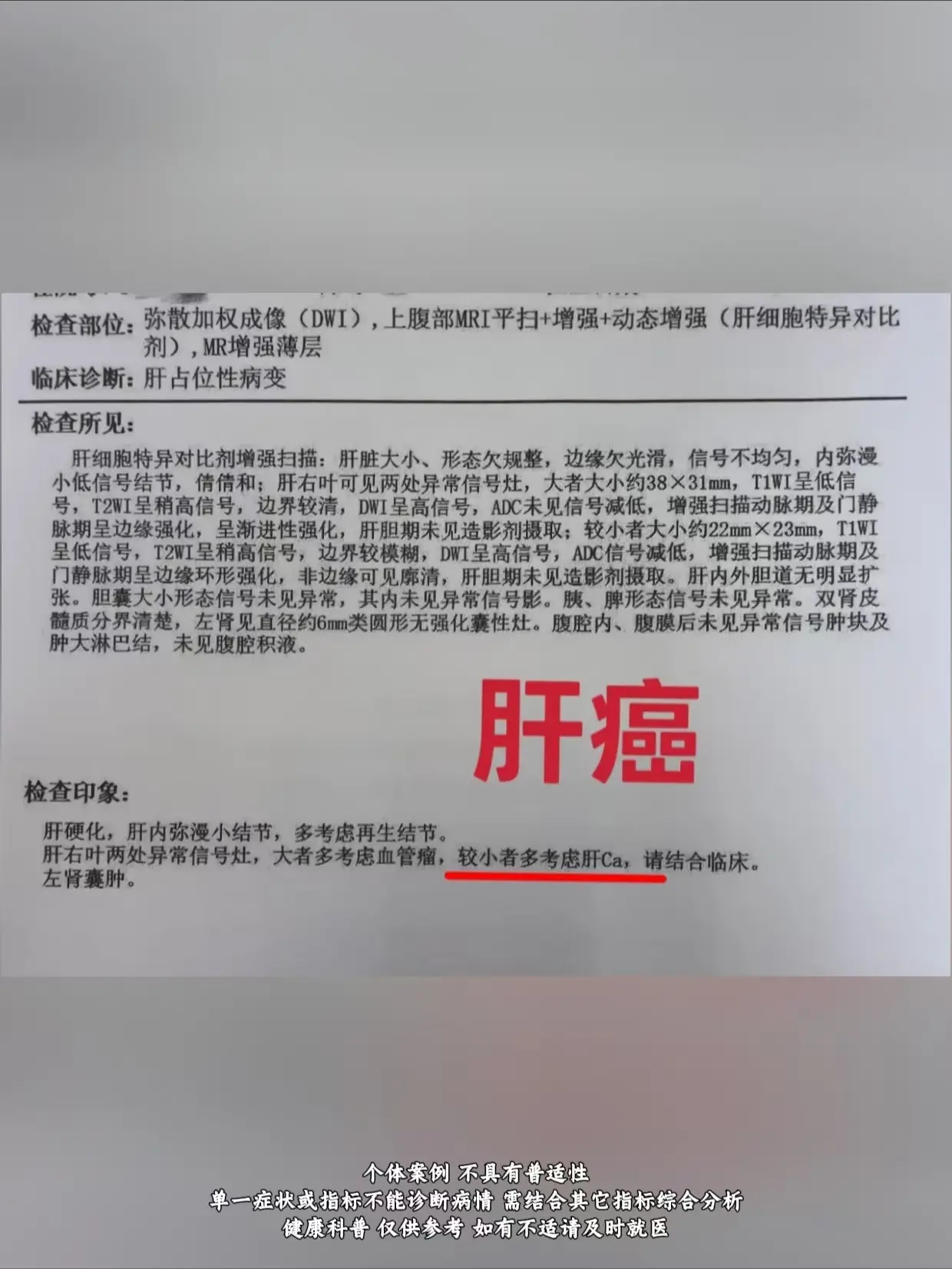 乙肝肝癌。患者自述：两年前在当地做过一次检查，检查结果显示肝功能和彩超...