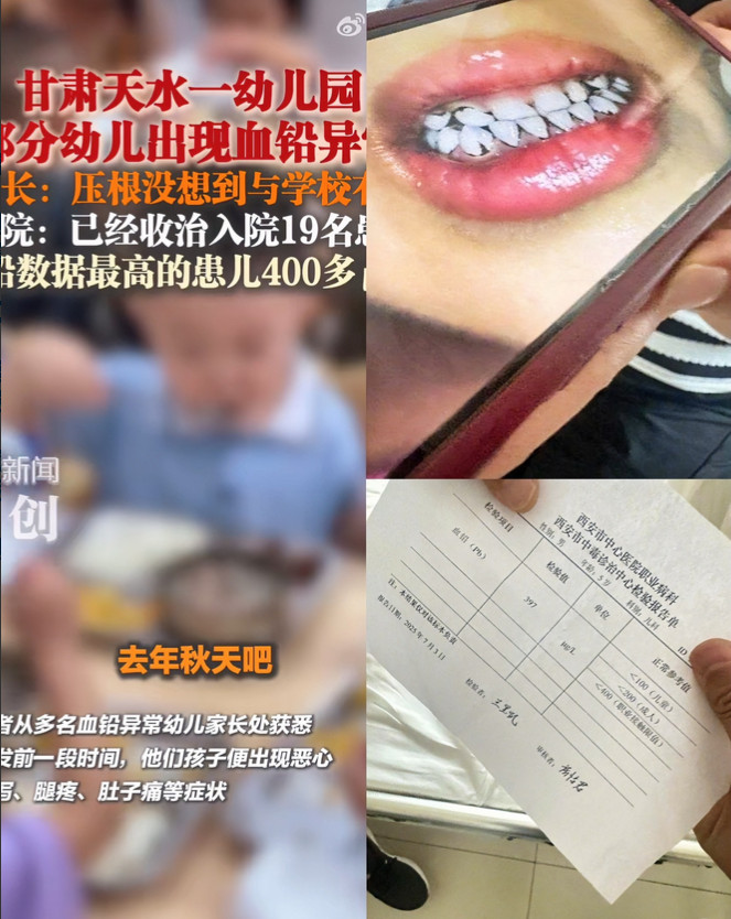 这是把幼儿园的孩子当日本人整啊？甘肃天水一私立幼儿园，19名儿童血铅集体中毒