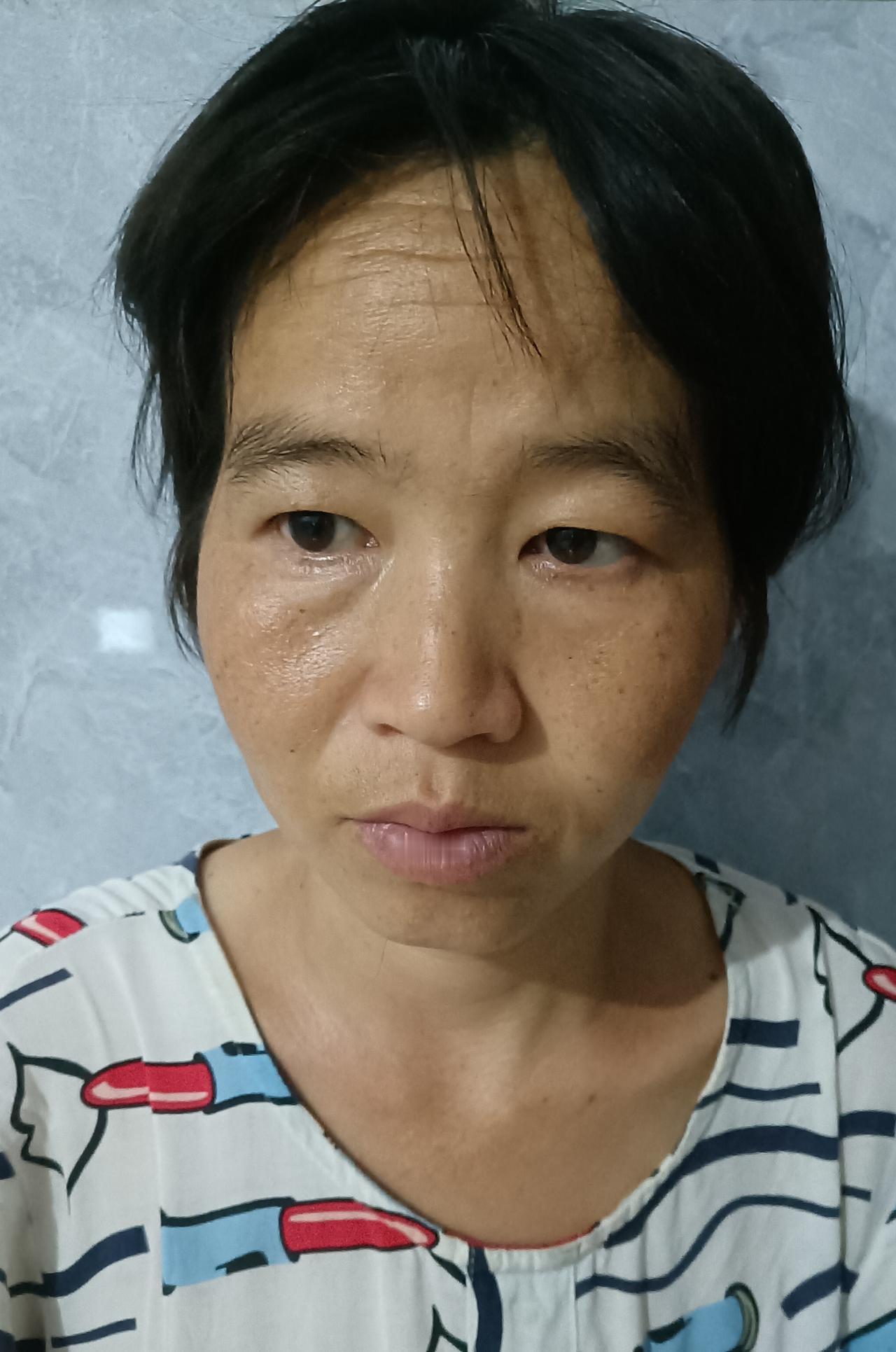 这几天突然右边下面的牙龈很痛，也可能是牙齿很痛。昨天一晚上翻来覆去的睡不着，我这
