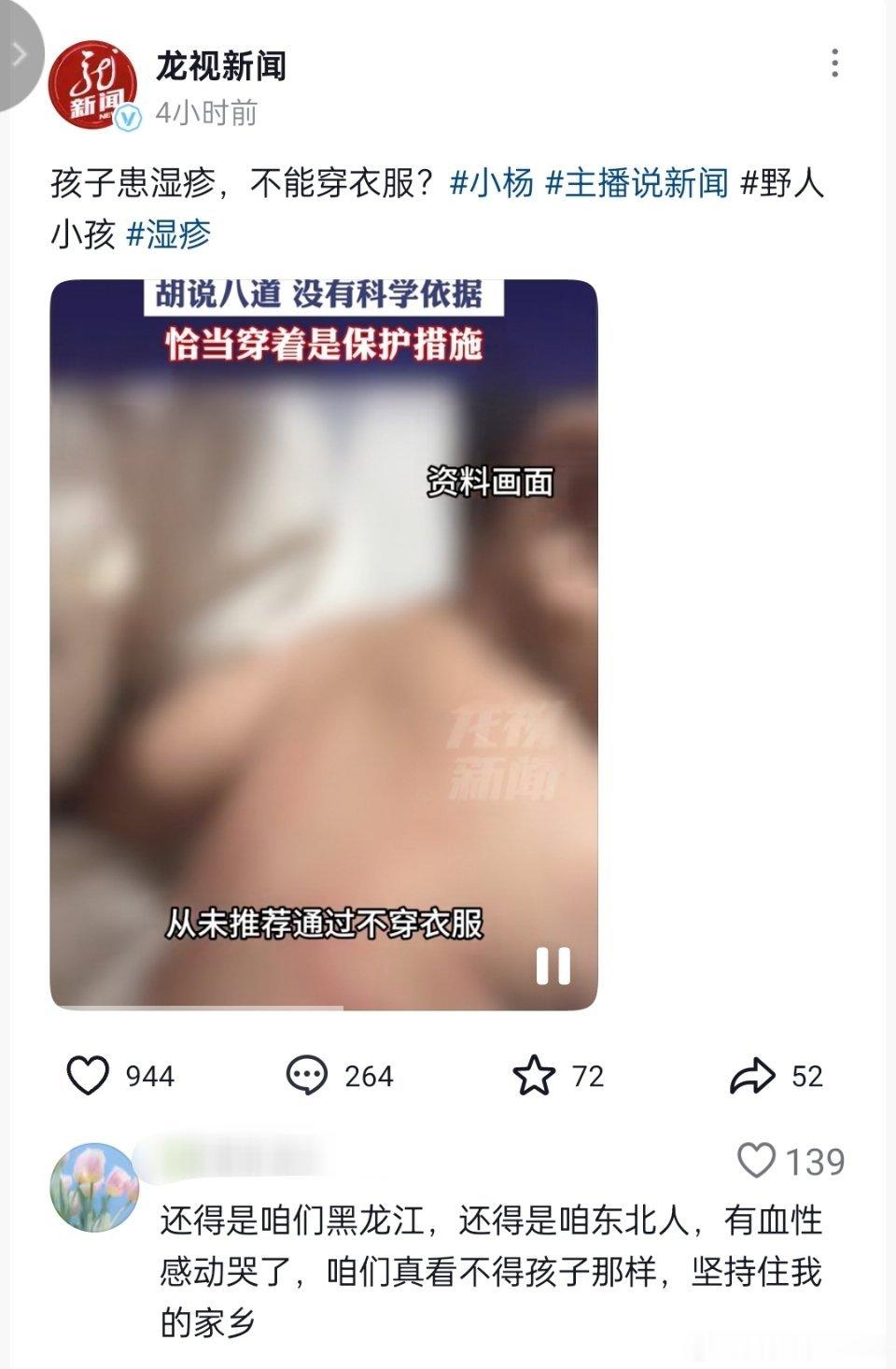 🔻惊!孩子患湿疹,不能穿衣服?胡说八道,没有科学依据,恰当穿着是保护措施。野人