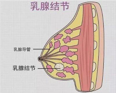 4A类结节，都要手术切除吗？医生给出专业建议疫情过后查出结节的人确实日益增多，