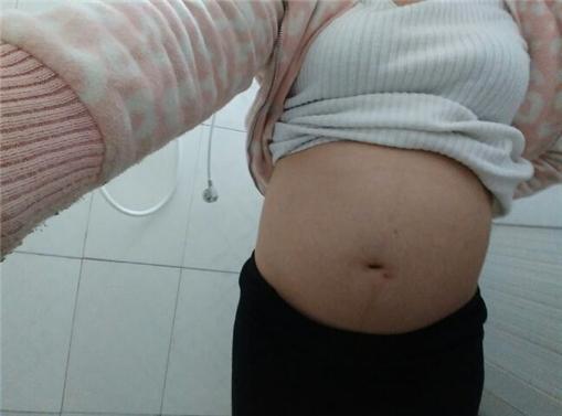 剖腹产子宫破裂, 医生让住院15天, 老公留下两个字走人了