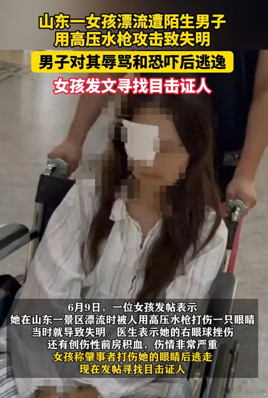 【急寻目击证人】山东男子用高压水枪强滋陌生女子，导致其失明，眼部血肉模糊。随后又
