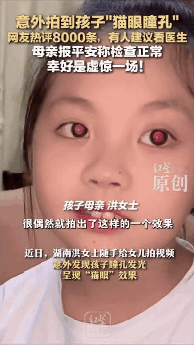 太神奇了！湖南，妈妈给女儿拍视频时，突然发现孩子眼睛不对劲，瞳孔里，竟然还有一层