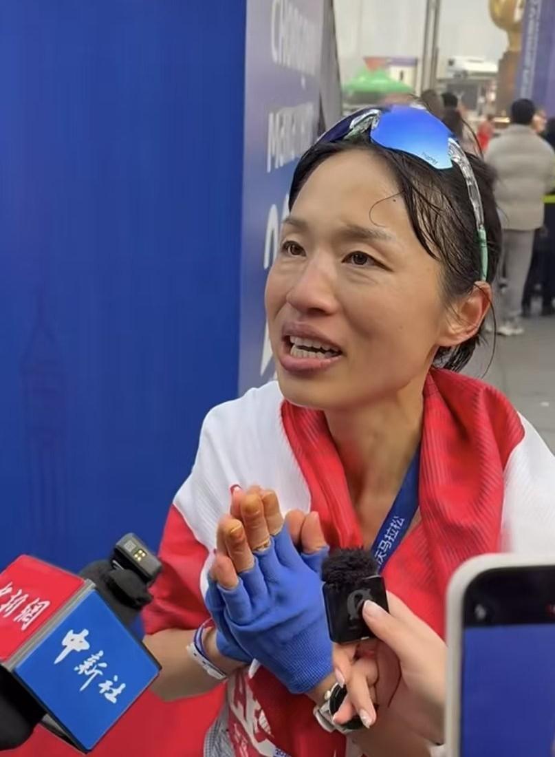 高强度运动后会出现脱水状态，张水华脸上出现很多皱纹，属于正常。参加2026重庆