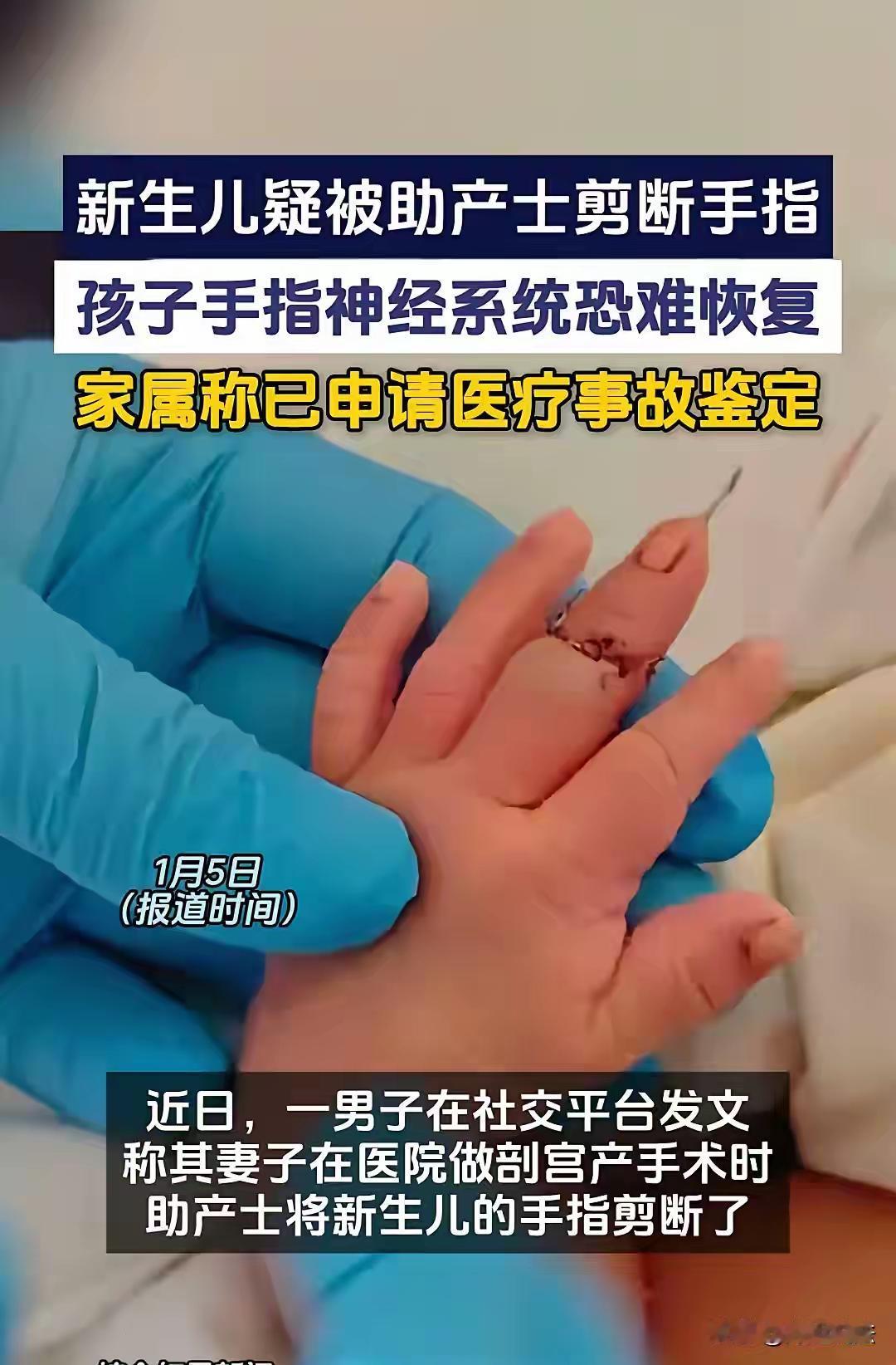 “一根手指才值10万吗？”江苏新生儿手指被助产护士剪断，院方称新生儿乱动所致，两