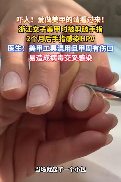 悲剧还是发生了！5月21日报道浙江杭州，一女子在美甲店修剪死皮时，不幸被未经严格