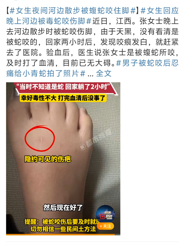 这次三亚蛇咬事件估计把三亚医院搞得头昏脑涨的应该这不刚刚江西又有一女子被蛇咬