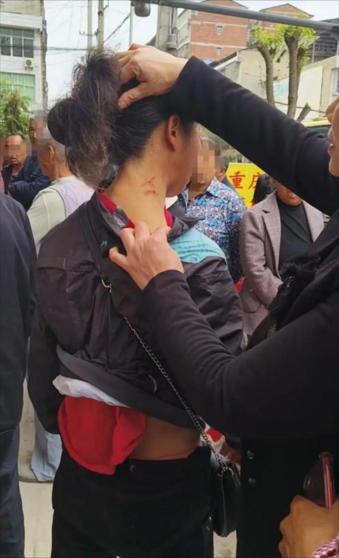 3娃妈被婆婆抓满脸血！5万块买断婚姻，隐身丈夫才是真狠人宁波这事儿，越想越