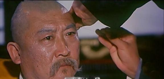 1914年，袁世凯头疼久治不愈，洋医束手无策，哪知中医黄石屏拿出一尺多长的金针，