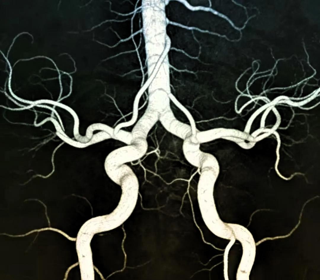 我一个朋友经常头痛、头晕，我昨天陪她去看了医生。在医生的强烈劝说下，她终于下定决