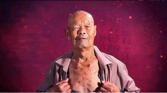 1956年，35岁的农民咳嗽10年，但却一直拒绝就医，一天，他突然用力一咳，一个