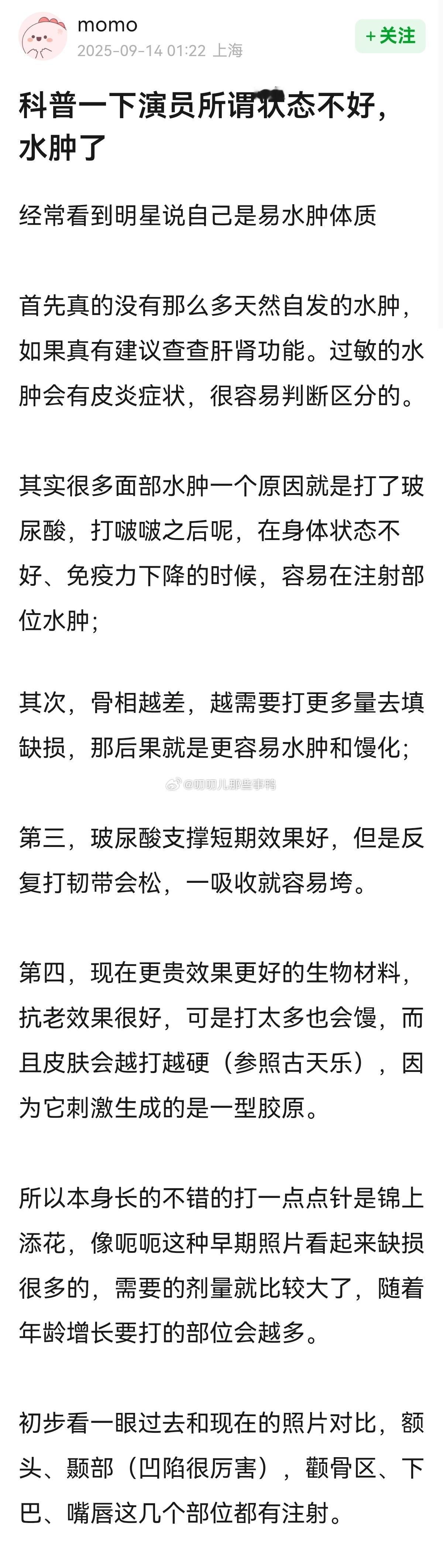 科普一下演员所谓状态不好，水肿了~​​​