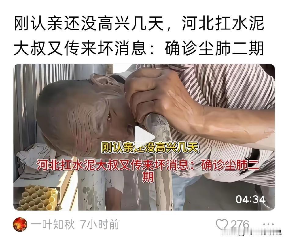 这下事大了，网传水泥大叔认亲之后确诊尘肺二期这样的话，强迫水泥大叔劳动二十年的