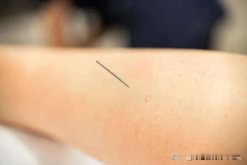 八大针灸致死穴位排行榜：第一名：风府穴、哑门穴*位置：后颈部