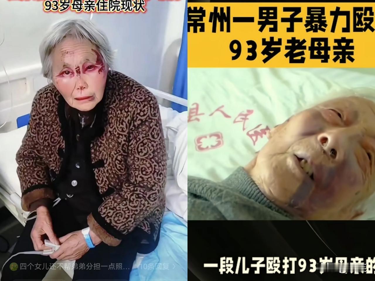 四个闺女一个儿子，儿女双全没给这位常州老人带来晚年幸福，却是不孝子令人发指的殴打