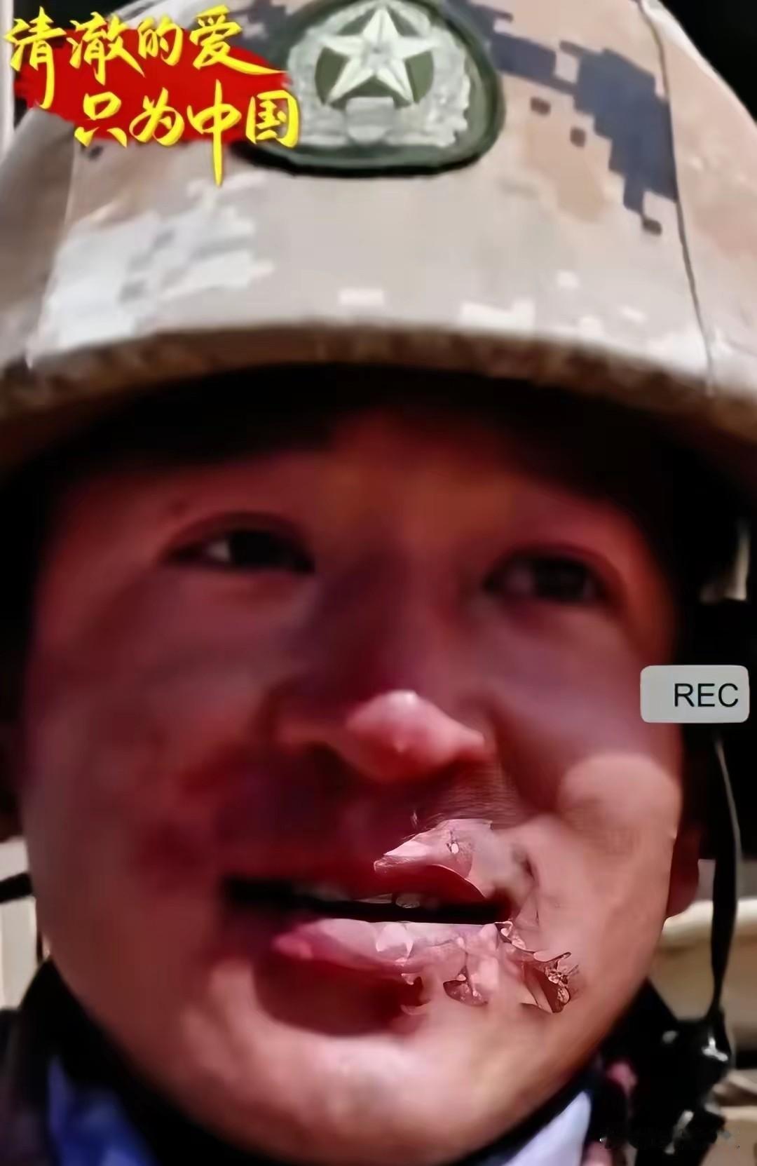 边防战士不肯摘面巾的温柔理由，看哭无数人记者采访边防战士时，战士却始终不肯