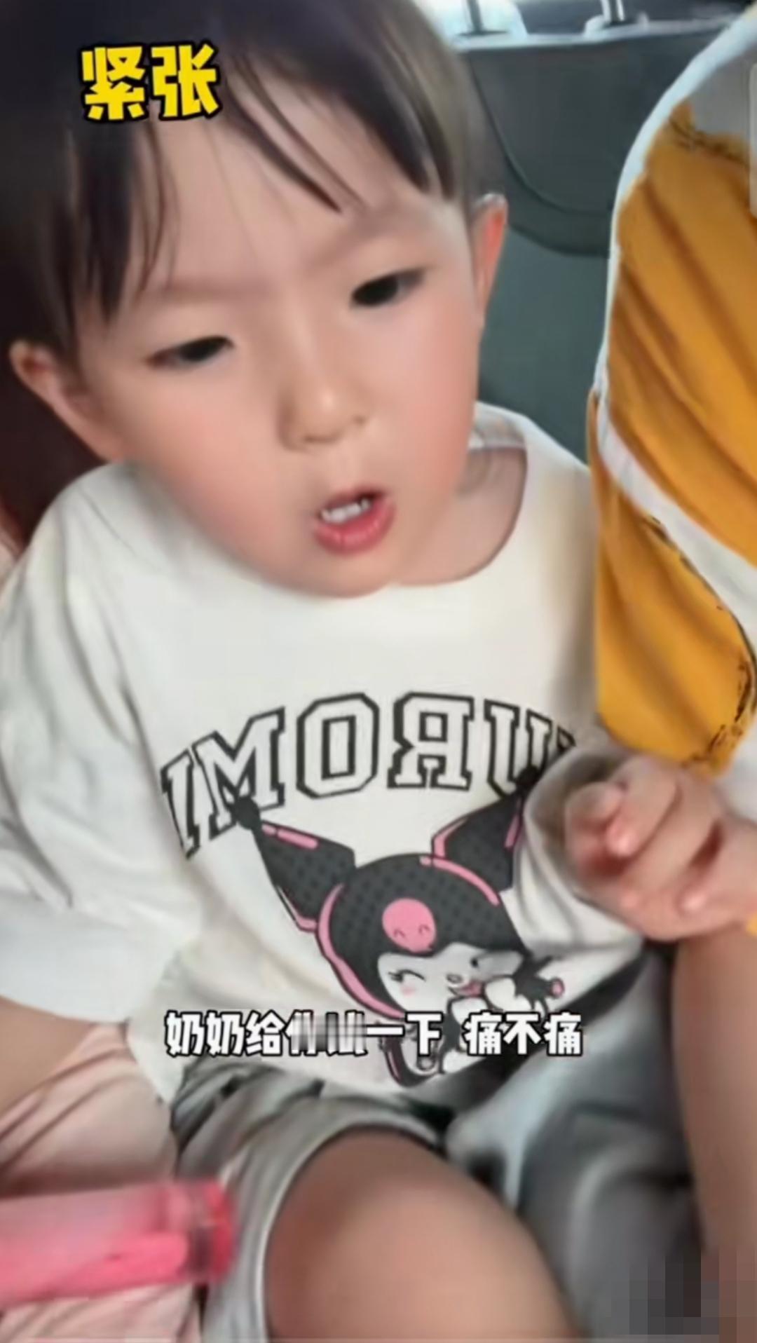 闪闪陪黄一鸣在海边卖了一上午芒果，收工后发现闪闪脚上磨出了一个大大的水泡！闪