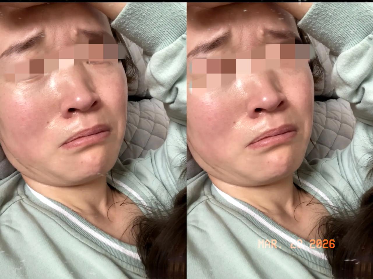 真是愁死了！我妹75年的，今年刚满52岁。年前还能跳广场舞能打麻将，可过了年之