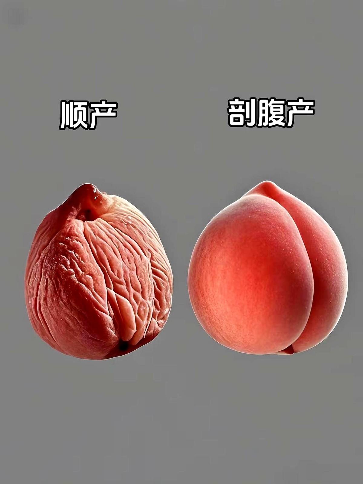 终于知道医生为啥都劝能顺就顺！你觉得是剖腹好还是顺的好呢？之前听产科朋友