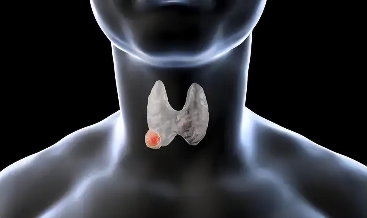 患上这4种癌，是不幸中的万幸：积极治疗，或和正常人一样长寿一听到癌，很多人脑