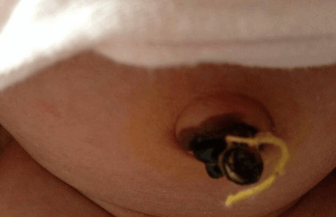 宝妈发现宝宝这些的部位比较脏, 不要想着弄干净