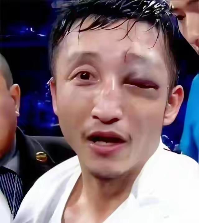邹市明要打拳击，最慌的还真不是他老婆，也不是他妈。是保险公司！估计收到消