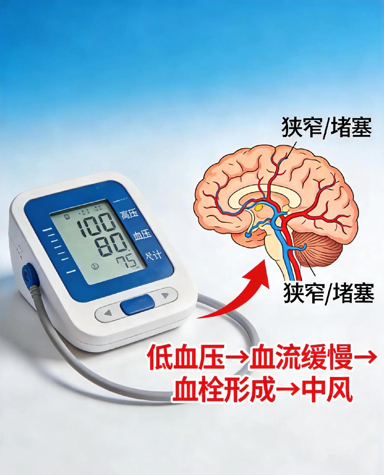 高血压会中风，低血压也会中风！很多人都不知道很多人以为，只有高血压才会中风