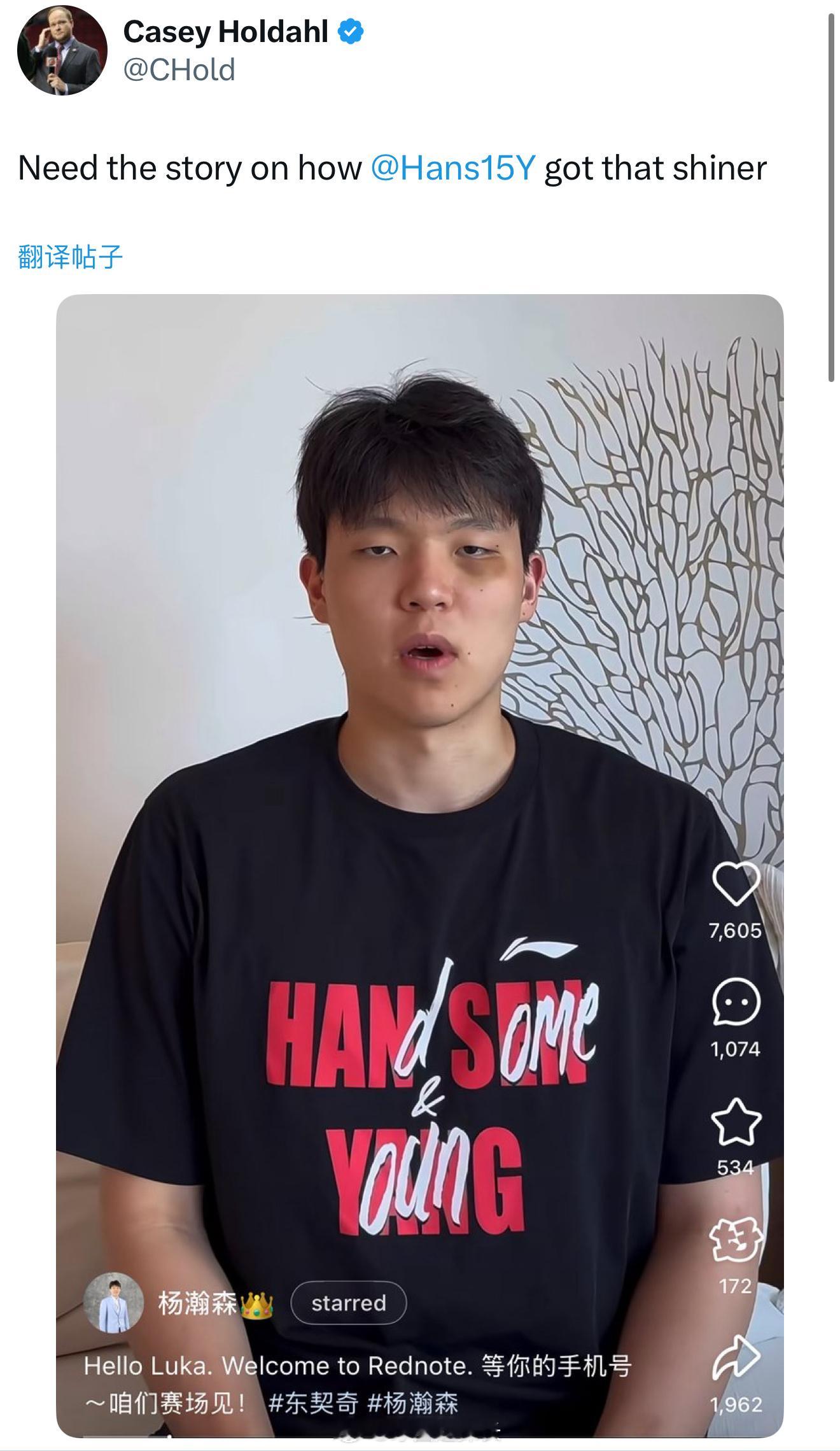 开拓者队记：想知道杨瀚森的黑眼圈是怎么来的至少证明NBA对抗不比CBA低的[do