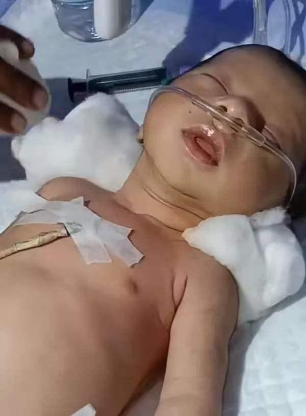 "看哭了！"医院产房里，一个刚出生的男婴没有呼吸，不会哭，不挣扎，全身青紫。Ap