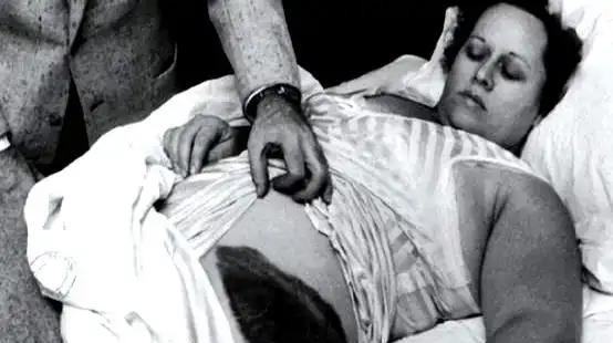 1954年，国外一女子正在睡觉中，突然感觉腹部和大腿被什么东西蹭着了一样，疼痛难