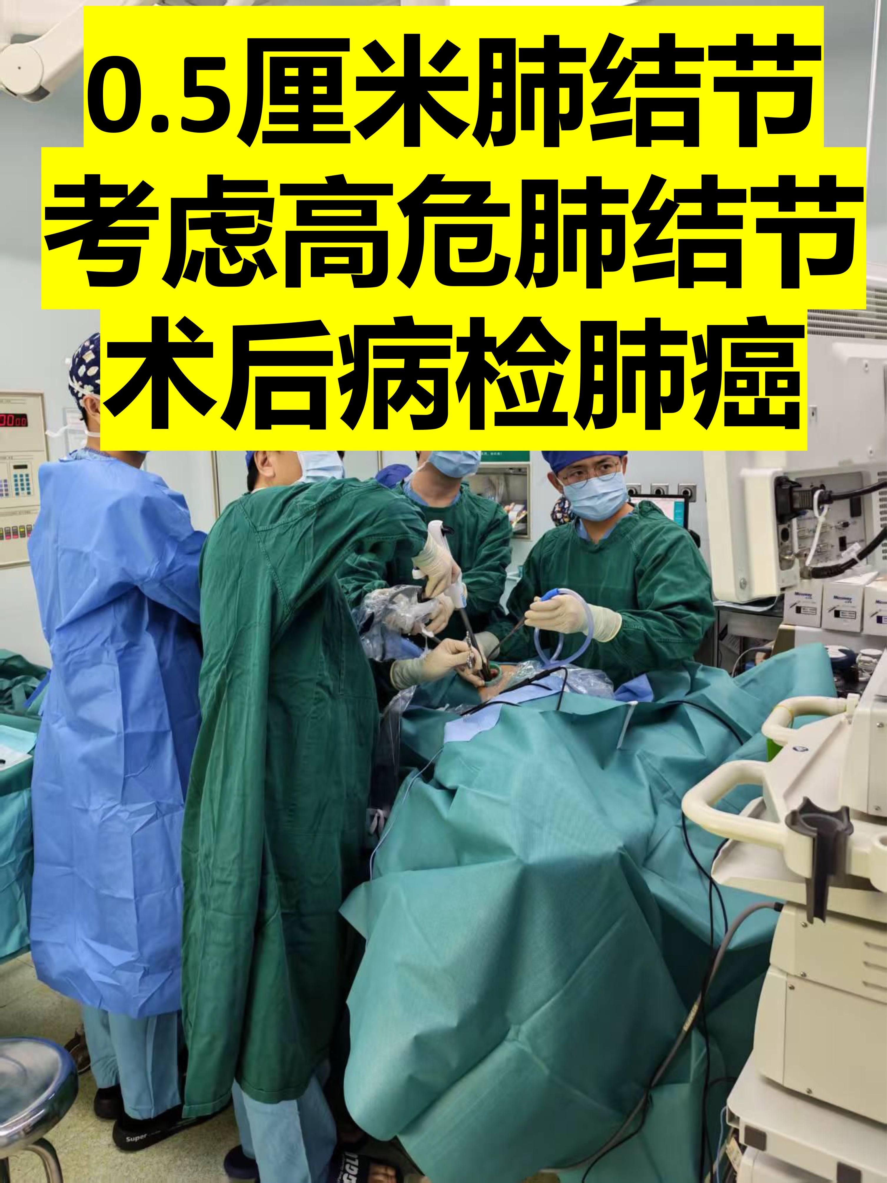 发现0,5厘米肺结节，高危结节，病检肺癌。周三出门诊，来了一位患者，自...