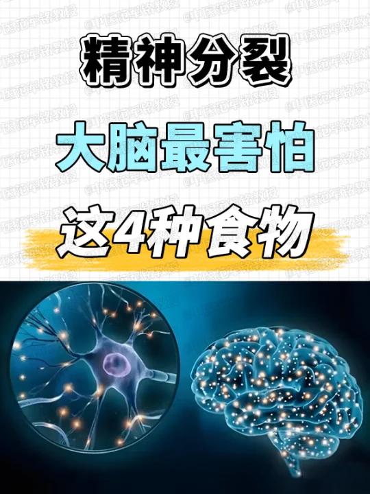 精神分裂，大脑最害怕，这4种食物 	 ﻿精神分裂﻿ ﻿双相情感障碍﻿ ﻿中医﻿