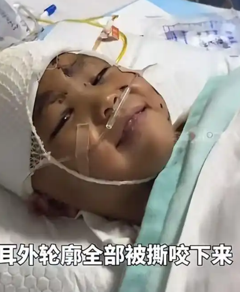 “中国青年报发声了！”7岁男孩被3只恶犬咬致重伤二级，治疗花20多万，狗主却只赔
