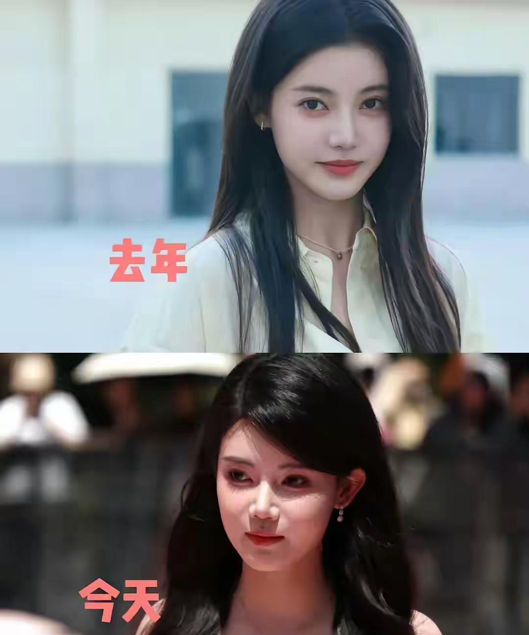 孙珍妮才25岁真的没必要那么快就去做医美因为女人的颜值鼎盛时期应该是30左右