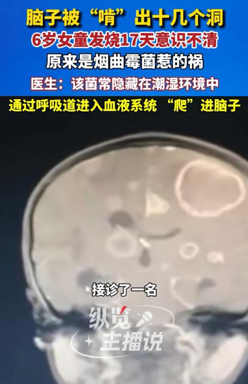 “太可怕了！”近日，河南，一6岁女孩连续几天高烧不退，吃了几天退烧药后仍不见好，