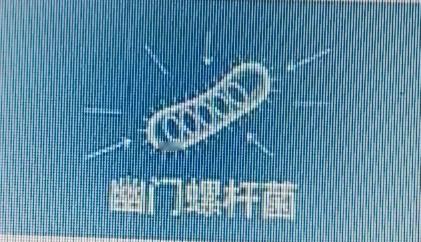 幽门螺杆菌这小妖精，在身体里捣乱时会发出信号。要是你频繁出现口臭，那可得留意了。