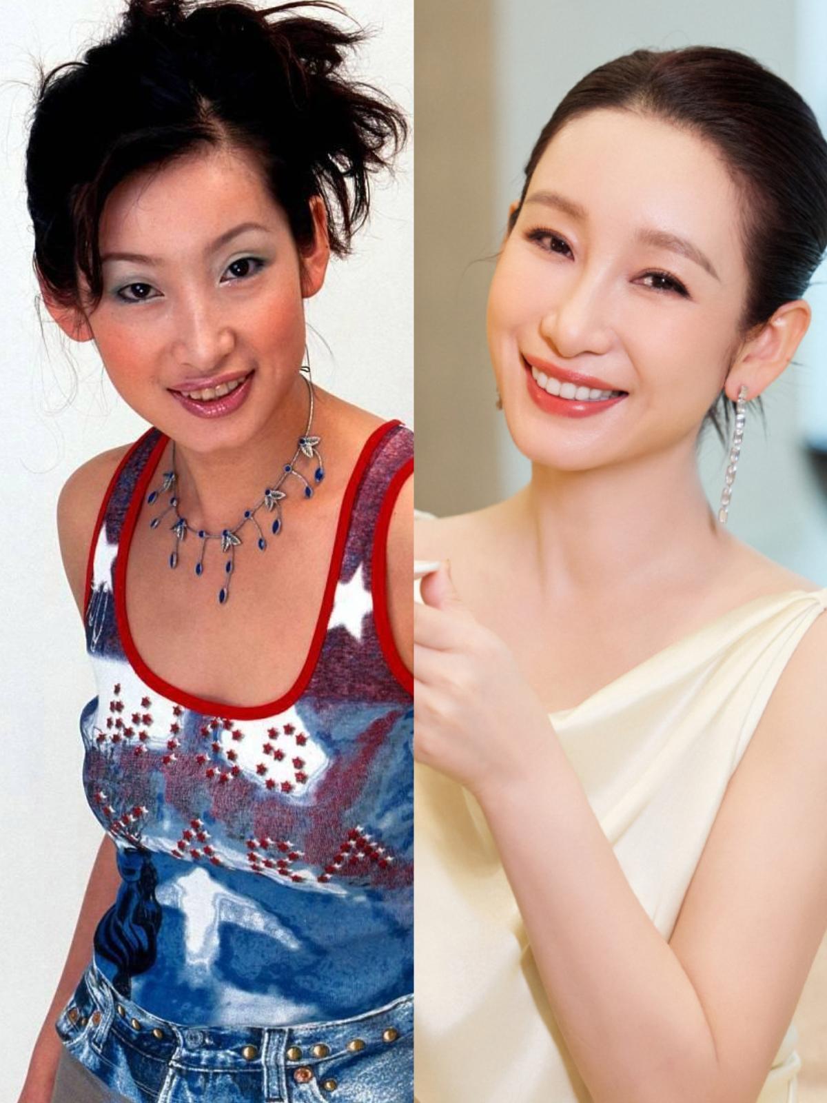 娱乐圈大家多多少少都整点容，但是群众对秦海璐却格外宽容。原因无外乎以下几点:1